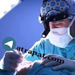 Rinoplasti Doç Dr Şaban Çelebi ✉️celebisaban@hotmail.com
0541 405 40 34 - 0532 218 18 71 -0532 573... ✉️celebisaban@hotmail.com
0541 405 40 34 Rinoplasti Doç Dr Şaban Çelebi ✉️celebisaban@hotmail.com