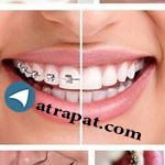 Dr. Parinaz Saeedi Orthodontist
Ahvaz Kianpars Ave., East Grade 2 Formation Complex
Phone:... Orthodontist
Ahvaz Kianpars Ave., East Grade 2 Formation Complex
P Dr. Parinaz Saeedi Orthodontist
Ahvaz Kianpars Ave., East Gr
