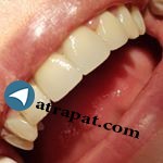 دندانپزشکی دندانبان مطب            ۴۶۸۹۱۶۶۹ ۰۲۱     