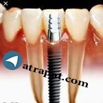 دندانپزشکی ماهان     ️پلی کلینیک ماهان     ️
دندان پزشکی    