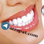 دکتر ارزو سعیدی دندانپزشک 
ونیر کامپوزیت 
لمینیت
درمان ریشه 