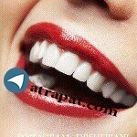 دکتر علی شیبانی دندانپزشک ترمیم های زیبایی ، لمینیت ، بلیچین