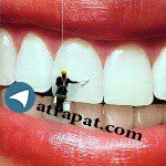سایت تخصصی دندانپزشکی زیبایی *
*سعادت اباد،بلوار دریا 193
*ت