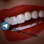 کلینیک دندانپزشکی درتیس @dorteeth dental
     09120123110
 ☎