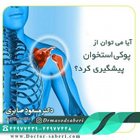 آیا می توان از #پوکی_استخوان پیشگیری کرد؟
برای پیشگیری از پوکی استخوان می توان اقداماتی انجام داد. در زیر به برخی از این اقدامات اشاره می کنیم: – #کلسیم – بدن در طول سال های رشد بیشترین نیاز به کلسیم را دارد تا استخوان هایی قوی ساخته شود. همچنین ذخیره کلسیم در این سال ها صورت می گیرد. در صورتی که در این سال ها کلسیم کافی به بدن نرسد احتمال بروز #پوکیاستخوان در سنین بالا وجود دارد. – #ویتامین_D – مصرف کافی #ویتامین D به جذب کلسیم کمک فراوانی می کند. البته مصرف بیش از اندازه ویتامین D می تواند سمی باشد. – ورزش کردن و فعالیت بدنی مناسب – همانند ماهیچه ها، استخوان ها هم به ورزش کردن احتیاج دارند. بخصوص ورزش کافی در سال‌های نوجوانی اهمیت فراوانی در ایجاد استخوان‌های قوی دارد. البته فایده ورزش کردن در تمام سنین باقی است و در هر سنی می تواند تراکم استخوان ها را بهبود بخشد. ۳ تا ۴ روز ورزش کردن متعادل در هفته می تواند فواید زیادی داشته باشد.
