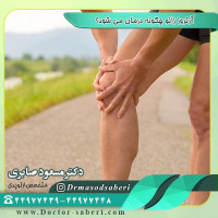 درمان #آرتروز_زانو
بسته به شدت بیماری #آرتروز زانو می توان از گزینه های مختلف درمانی استفاده نمود:
-	کاهش #وزن . مهم‌ترین بخش درمان است. -خودداری از نشستن روی زمین، توالت ایرانی و استفاده زیاد از پله
-	ورزش کردن هدفمند برای تقویت عضله چهارسر و حرکات کششی برای کاهش سفتی همسترینگها
-	استفاده از داروهای مسکن و ضد التهابی مانند ایبوپروفن و ناپروکسن
-	تزریق کورتیکواستروئید
-	استفاده از عصا برای راه رفتن
-	#جراحی_تعویض_مفصل_زانو