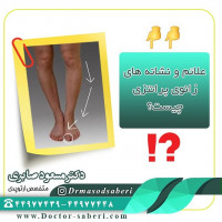 علائم زانوی پرانتزی
