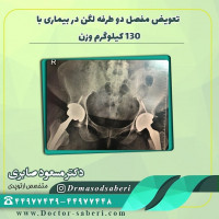 ✏تعویض مفصل دو طرفه لگن در بیماری با ۱۳۰ کیلوگرم وزن
.
.
#جراحیلگن
#تعویضمفصللگن
#متخصصارتوپدی