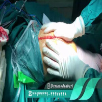 ✔مراحل مقدماتی تعویض مفصل زانو توسط دکتر مسعود صابری (متخصص ارتوپدی)
.
.
.
.
#تعویض_مفصل_زانو
#تعویض_مفصل
#متخصص_ارتوپدی
#دکتر_مسعود_صابری