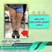 #تعویض_مفصل_زانو
#تعویض_مفصل
#دکتر_مسعود_صابری