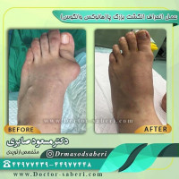 #دکتر_مسعود_صابری
#متخصص_ارتوپدی
#ارتوپدی
