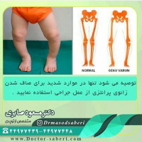 #عمل_پرانتزی_زانو
#زانودرد
#زانو_درد
#دردزانو
#ارتوپد
#ارتوپدی
#متخصص_ارتوپدی
#تعویض_مفصل_زانو
#پای_پر‌انتزی
#زانوی_پرانتزی
#نرمی_کشکک_زانو