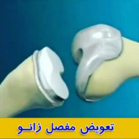 #عمل_پرانتزی_زانو
#زانودرد
#زانو_درد
#دردزانو
#ارتوپد
#ارتوپدی
#متخصص_ارتوپدی
#تعویض_مفصل_زانو
#پای_پرانتزی
#زانوی_پرانتزی
#نرمی_کشکک_زانو
#دررفتگی_لگن
#تعویض_مفصل
#کف_پای_صاف
#تعویض_مفصل_زانو