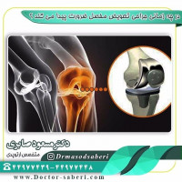در چه زمانی جراحی تعویض مفصل ضرورت پیدا می کند ؟

در بسیاری از موارد تخریب مفصل جزئی می باشد و بیمار مشکل چندانی با آن ندارد ممکن است بیمار یک آرتروز خفیفی داشته باشد در سن 50 یا 60 سال که می توان به راحتی با راهنمایی و مشاوره هایی که پزشک در اختیار آنها می گذارد و تقویت عضلات و مصرف برخی از مسکن های ساده احساس درد را کاهش داد و زندگی روزانه خود را داشته باشند در این افراد به هیچ عنوان تعویض مفصل توصیه نمی شود حتی در موارد خیلی شدید تر بدون عمل تعویض مفصل با اعمال جراحی های ساده تر بیماری قابل درمان است زمانی جراحی تعویض مفصل در بیماری توصیه می شود که تخریب وسیعی در غصروف مفصل اتفاق افتاده باشد که با استفاده از روش دیگری نتوان آن را درمان کرد و بیمار درد و ناتوانی شدید  داشته باشد در این صورت است که تعویض مفصل تنها راه می باشد و می تواند کمک بسیار شایانی به بیمار بکند .

#عمل_پرانتزی_زانو
#زانودرد
#زانو_درد
#دردزانو
#ارتوپد
#ارتوپدی
#متخصص_ارتوپدی
#تعویض_مفصل_زانو
#پای_پرانتزی
#زانوی_پرانتزی
#نرمی_کشکک_زانو
#دررفتگی_لگن
#تعویض_مفصل_لگن
#کف_پای_صاف