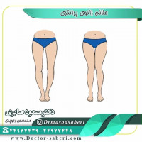 علائم زانوی پرانتزی
