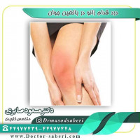 ⭕️⭕️درد قدام زانو در بالغین جوان : قسمت اول
معمولا علت درد فعالیت ھای شدید روتین در زانو ھایی می باشد کہ قدرت کافی عضلات اطراف زانو را ندارند.
در اغلب موارد این درد با ورزشھای تقویتی،استراحت،داروھای ضد التھاب سادہ برطرف شدہ و فرد می تواند بہ ورزش یا فعالیت روزانہ مورد علاقہ خود باز گردد.

#زانو
#عمل_پرانتزی_زانو
#زانودرد
#زانو_درد
#دردزانو
#ارتوپد
#ارتوپدی
#متخصص_ارتوپدی
#تعویض_مفصل_زانو