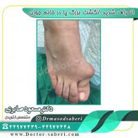#متخصص_ارتوپدی
#متخص_ارتوپد
#ارتوپد
#ارتوپدی
#جراحی_پا
#جراحی_پای_پرانتزی