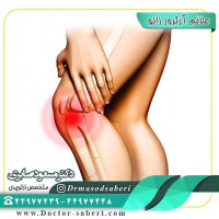 علائم آرتروز زانو

