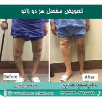 #زانو
#عمل_پرانتزی_زانو
#زانودرد
#زانو_درد
#دردزانو
#ارتوپد
#ارتوپدی
#متخصص_ارتوپدی
#تعویض_مفصل_زانو
#پای_پرانتزی
#زانوی_پرانتزی