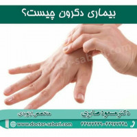بیماری دکرون چیست؟
