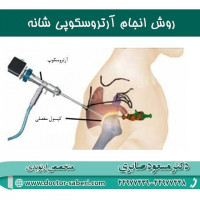 روش انجام #آرتروسکوپی_شانه

اکثر بیمارانی که تحت عمل آرتروسکوپی شانه قرار گرفته‌اند در مدت زمان کمی بهبود می‌یابند. روشهای کم‌تهاجمی جدید و تجهیزات پیشرفته‌تر آرتروسکوپی به شما در تسریع فرآیند بهبود یاری می‌رسانند. این جراحی بیشتر مواقع به صورت سرپایی انجام می‌شود و هنگام عمل تنها سه یا چهار برش کوچک در ناحیه ایجاد می‌کنند که از درد بعد از عمل می‌کاهد و جای زخم اندکی بر جای می‌ماند.

#زانو
#عمل_پرانتزی_زانو
#زانودرد
#زانو_درد
#دردزانو
#ارتوپد
#ارتوپدی
#متخصص_ارتوپدی
#تعویض_مفصل_زانو
#پای_پرانتزی
#زانوی_پرانتزی
#مچ_پا
#مچ
#درد_مچ_پا
#شکستگی
#پیچ_خوردگی
#دکرون
#بیماری_دکرون
#دیسک_کمر
#دیسک
#عمل_جراحی_ران