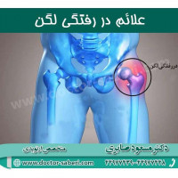 علائم در رفتگی لگن
