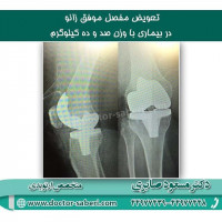 #زانو
#عمل_پرانتزی_زانو
#زانودرد
#زانو_درد
#دردزانو
#ارتوپد
#ارتوپدی
#متخصص_ارتوپدی
#تعویض_مفصل_زانو
#پای_پرانتزی
#زانوی_پرانتزی