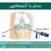 روش درمان با آرتروسکوپی
