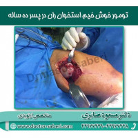 #زانو
#عمل_پرانتزی_زانو
#زانودرد
#زانو_درد
#دردزانو
#ارتوپد
#ارتوپدی
#متخصص_ارتوپدی
#تعویض_مفصل_زانو
#پای_پرانتزی
#زانوی_پرانتزی
#مچ_پا
#مچ
#درد_مچ_پا
#شکستگی
#پیچ_خوردگی
#دکرون
#بیماری_دکرون
#دیسک_کمر
#دیسک
#عمل_جراحی_ران