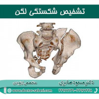 تشخیص شکستگی لگن
