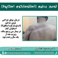 #زانو
#عمل_پرانتزی_زانو
#زانودرد
#زانو_درد
#دردزانو
#ارتوپد
#ارتوپدی
#متخصص_ارتوپدی
#تعویض_مفصل_زانو
#پای_پرانتزی
#زانوی_پرانتزی
#مچ_پا
#مچ
#درد_مچ_پا
#شکستگی
#پیچ_خوردگی
#دکرون
#بیماری_دکرون
#دیسک_کمر
#دیسک
#عمل_جراحی_ران