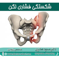شکستگی فشاری لگن
