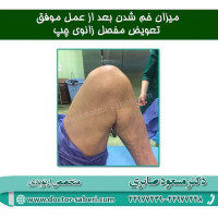 #زانو
#عمل_پرانتزی_زانو
#زانودرد
#زانو_درد
#دردزانو
#ارتوپد
#ارتوپدی
#متخصص_ارتوپدی
#تعویض_مفصل_زانو
#پای_پرانتزی
#زانوی_پرانتزی
#مچ_پا
#مچ
#درد_مچ_پا
#شکستگی
#پیچ_خوردگی
#دکرون
#بیماری_دکرون
#دیسک_کمر
#دیسک