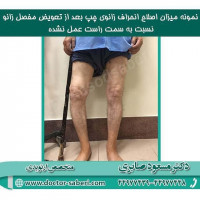 #زانو
#عمل_پرانتزی_زانو
#زانودرد
#زانو_درد
#دردزانو
#ارتوپد
#ارتوپدی
#متخصص_ارتوپدی
#تعویض_مفصل_زانو
#پای_پرانتزی
#زانوی_پرانتزی
#مچ_پا
#مچ
#درد_مچ_پا
#شکستگی
#پیچ_خوردگی
#دکرون
#بیماری_دکرون
#دیسک_کمر
#دیسک