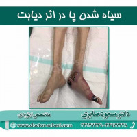 #زانو
#عمل_پرانتزی_زانو
#زانودرد
#زانو_درد
#دردزانو
#ارتوپد
#ارتوپدی
#متخصص_ارتوپدی
#تعویض_مفصل_زانو
#پای_پرانتزی
#زانوی_پرانتزی
#مچ_پا
#مچ
#درد_مچ_پا
#شکستگی
#پیچ_خوردگی
#دکرون
#بیماری_دکرون
#دیسک_کمر
#دیسک