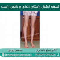 #زانو
#عمل_پرانتزی_زانو
#زانودرد
#زانو_درد
#دردزانو
#ارتوپد
#ارتوپدی
#متخصص_ارتوپدی
#تعویض_مفصل_زانو
#پای_پرانتزی
#زانوی_پرانتزی
#مچ_پا
#مچ
#درد_مچ_پا
#شکستگی
#پیچ_خوردگی
#دکرون
#بیماری_دکرون
#دیسک_کمر
#دیسک