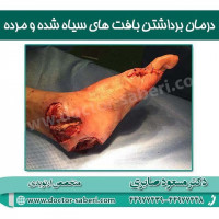 #زانو
#عمل_پرانتزی_زانو
#زانودرد
#زانو_درد
#دردزانو
#ارتوپد
#ارتوپدی
#متخصص_ارتوپدی
#تعویض_مفصل_زانو
#پای_پرانتزی
#زانوی_پرانتزی
#مچ_پا
#مچ
#درد_مچ_پا
#شکستگی
#پیچ_خوردگی
#دکرون
#بیماری_دکرون
#دیسک_کمر
#دیسک