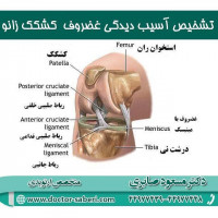 تشخیص
