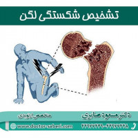 تشخیص شکستگی لگن
