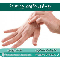 بیماری دکرون چیست؟
