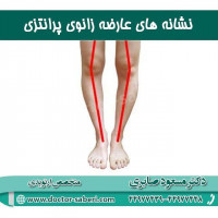 نشانه های زانوی پرانتزی
