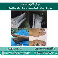 #زانو
#عمل_پرانتزی_زانو
#زانودرد
#زانو_درد
#دردزانو
#ارتوپد
#ارتوپدی
#متخصص_ارتوپدی
#تعویض_مفصل_زانو