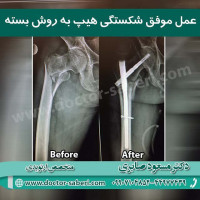 #ارتوپد #جراحی_ارتوپد #مفصل_زانو #جراحیارتوپد #مفصل_لگن#جراحی_زانو #جراحی_لگن #جراحیزانو #ارتوپدی
#دکترصابری
#متخصص_ارتوپدی
#ارتوپدی