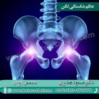 علائم #شکستگی_لگن
عدم توانایی حرکت پس از زمین خوردن  درد شدید در باسن و کشاله ی ران  ناتوانی در انداختن وزن بدن بر روی طرف آسیب دیده ی لگن  گرفتگی، تورم و کبودی در اطراف باسن و لگن  کوتاه تر بودن پا در طرف آسیب دیده ی لگن  پیچیده پا به سمت خارج در طرف آسیب دیده ی لگن
https://t.me/drmasodsaberi
https://www.instagram.com/drmasodsaberi/