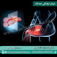 ⭕️درمان گرفتگی عضلات  در صورتی که دچار گرفتگی عضلات شدید با روش های ساده می توانید آن را درمان کنید. در این مواقع عضلات را به آرامی کشش دهید یا آرام ماساژ دهید.  استفاده از حوله آب گرم یا سرد به بهبودی گرفتگی عضلات کمک می کند.  حمام آب گرم نیز برای رعف گرفتگی عضلات موثر می باشد .
#گرفتگی_عضلات #گرفتگي #گرفتگیعضلات