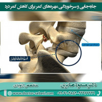 ⭕️⭕️
عارضه ی سرخوردگی مهره کمر،که مهره‌های پایین‌تر (استخوان‌های ستون فقرات) را درگیر می‌کند. در این بیماری، یکی از مهره‌های پایین کمر بر روی استخوانی که مستقیماً در زیر آن قرار دارد، لغزیده و سر می‌خورد. سرخوردن مهره کمر یک بیماری دردناک است، اما در اغلب موارد قابل درمان می‌باشد.
https://t.me/drmasodsaberi
https://www.instagram.com/drmasodsaberi/
#کمردرد #کمردرد