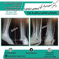 #ارتوپد #جراحی_ارتوپد #مفصل_زانو #جراحیارتوپد #مفصل_لگن #جراحی_زانو #جراحی_لگن #جراحیزانو #ارتوپدی