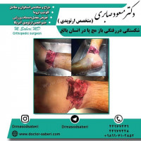 #ارتوپد #جراحی_ارتوپد #مفصل_زانو #جراحیارتوپد #مفصل_لگن #جراحی_زانو #جراحی_لگن #جراحیزانو #ارتوپدی