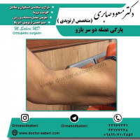 پارگی عضله دو سر بازو
پارگی عضله دو سر بازو در سنین جوانی اغلب ناشی از فشارها  و ضربه های شدید می باشد. مثلا بیماری که وزنه بردار می باشد و وزنه بسیار سنگینی را می خواهد از ناحیه ساعد به صورت خم کردن آرنج بلند کند و ناگهان نیرویی به ساعد وارد می کند که این حرکت باعث می شود فرد احساس درد بکند و گاها صدایی در دست نیز بروز می کند. بعد از آن فرد دچار کبودی و ورم می شود و در حرکات آرنج خود دچار محدودیت می شود و در سنین بالاتر اغلب با فشارها و ضربه های کوچک مانند کارهای روزمره (مثلا زمانی که بیمار دست خود را به دیوار می زند که بخواهد بلند بشود) ناگهان بیمار دردی را احساس می کند و سپس دچار محدودیت در حرکت میشود، که این محدودیت ها ناشی از پارگی عضله دو سر بازو می باشد.
 عضله دو سر بازو به دو قسمت نزدیک شانه و نزدیک آرنج تقسیم می شوند که پارگی های نزدیک شانه اغلب شایع تر می باشد و در سنین بالاتر هم با ضربه های ناچیز نیز ایجاد خواهند شد. معمولا در سنین بالا به دلیل اینکه بیمار خیلی احساس نیاز به آن عضله ندارد و سایر عضله ها آن را پوشش می دهند اغلب به جراحی نیاز نخواهد داشت. اما در سنین پایین تر بخصوص بیمارانی که ورزش می کنند به دلیل اینکه این پارگی باعث تحلیل 30 درصدی قدرت آرنج بیمار می شود، جراحی را در اولین فرصت و سریعا انجام می دهند.به همین دلیل می باشد که هرچه از زمان پارگی عضله بیشتر بگذرد ترمیم و جراحی مشکل تر خواهد شد.در مواردی هم که بیش از یک ماه از پارگی عضله دو سر بازو گذشته باشد امکان ترمیم دیگر وجود نخواهد داشت و باید بازسازی صورت بگیرد. در افرادی که مسن هستند برای بیمار از یک آویز گردنی استفاده خواهد شد و مسکن نیز تجویز می شود و به بیمار استفاده از یخ توصیه می شود. بیمار پس از گذشت دو هفته می تواند فیزیوتراپی را شروع کند. فیزیوتراپی به بیمار کمک خواهد کرد که بتواند تا حدودی قدرت از دست رفته خود را بازیابد. اما به طور کلی حدود 30 درصد از قدرت خم کردن آرنج و حدود 15 تا 17 درصد نیز از قدرت برگرداندن ساعد به سمت خارج کاسته خواهد شد. عکس زیر نیز نشان دهنده پارگی عضله دو سر بازو از نزدیکی شانه در یک فرد مسن می باشد که با فشاری بسیار کوچک و با بلند کردن بسته خرید دچار این مشکل شده است. در این بیماران به دلیل اینکه عضله از بالا آزاد می شود حالتی در دست ایجاد می شود که پاپ آی نامیده می شود. در این حالت عضله در وسط دست جمع می شود که یکی از مهم ترین علائم مشخصه پارگی عضله دو سر بازو می باشد که در افراد جوان هم دیده می شود.

#ارتوپد #جراحی_ارتوپد #مفصل_زانو #جراحیارتوپد