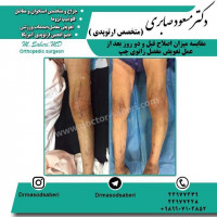 #ارتوپد #جراحی_ارتوپد #مفصل_زانو #جراحیارتوپد #مفصل_لگن#جراحی_زانو #جراحی_لگن #جراحیزانو #ارتوپدی